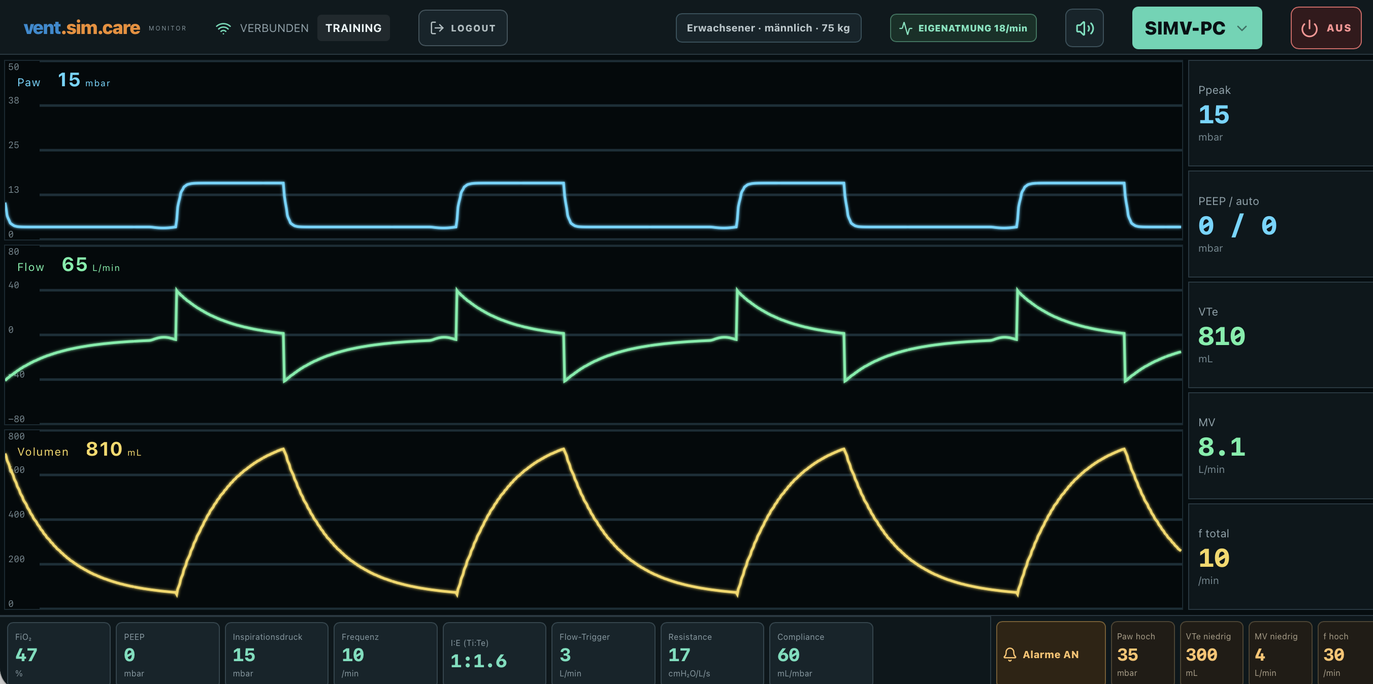 vent.sim.care Beatmungssoftware